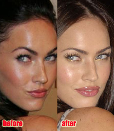 megan fox before and after nose job. megan fox nose job « Megan Fox